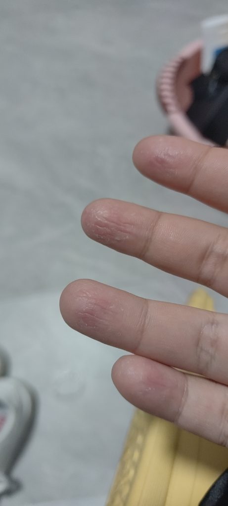 上实验课但材料过敏 哈哈哈哈哈操-吐槽社区-情绪-猫匿社区